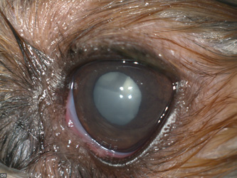 Набухающая катаракта, фото