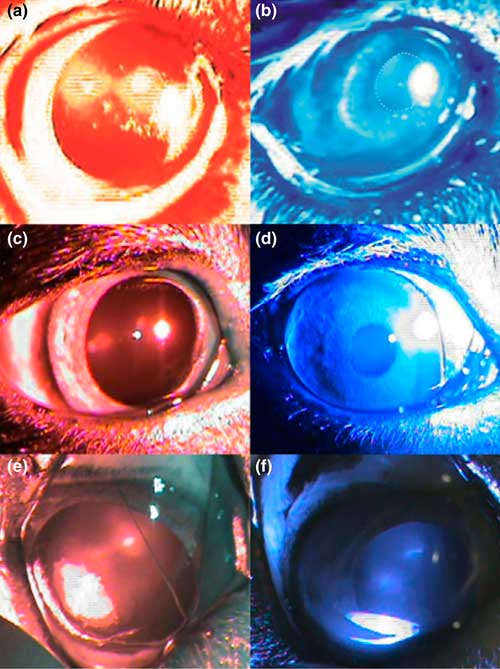 Рак-ассоциированная ретинопатия - зрачковый рефлекс
